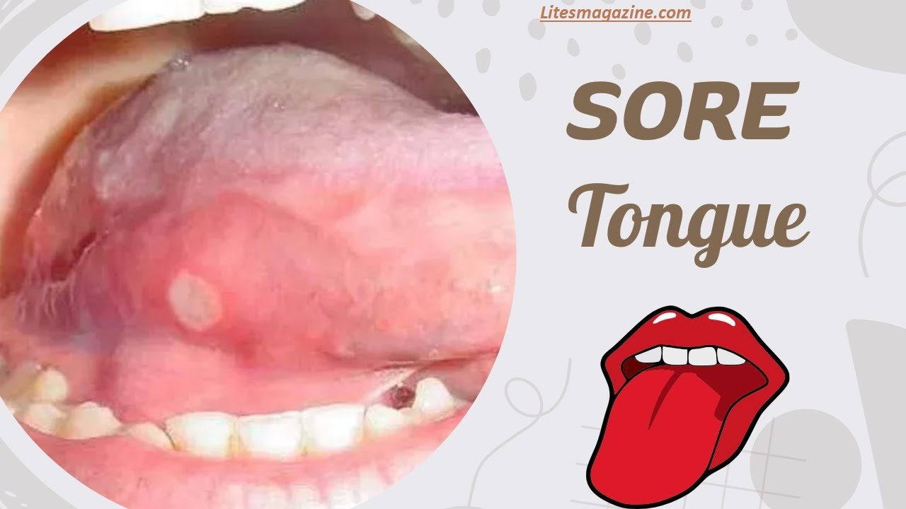 Why Does My Tongue Hurt Suddenly? Causes & Quick Fixes