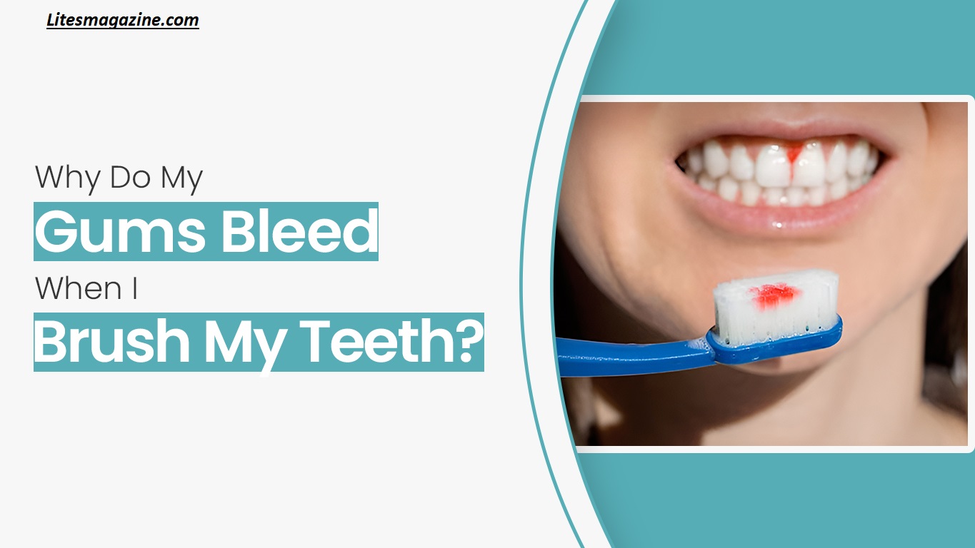 Why Do My Gums Bleed When I Brush My Teeth? Causes & Quick Fixes