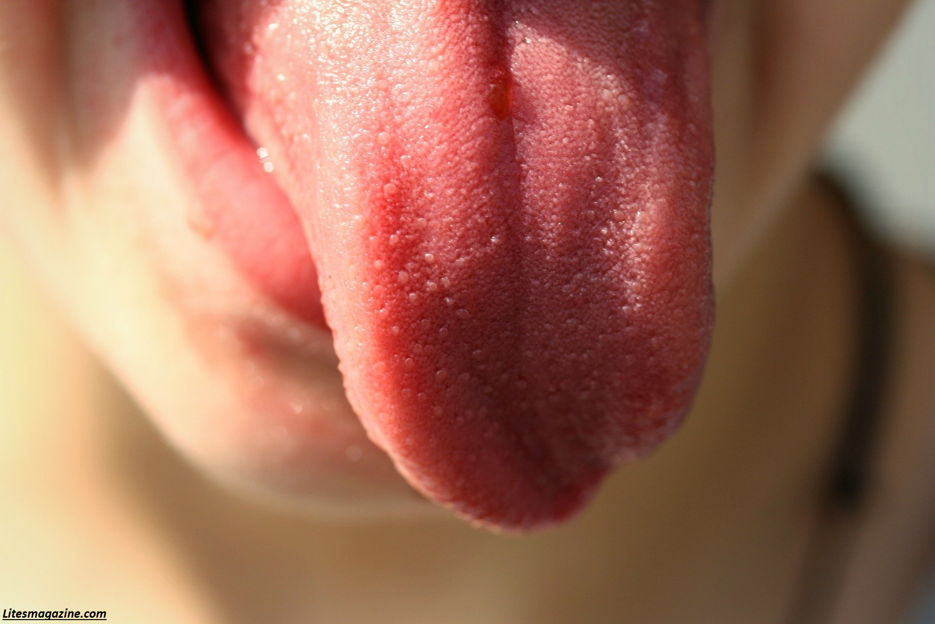 Why Does the Tip of My Tongue Hurt? 9 Surprising Causes